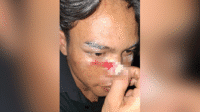 Mahmudi, Ketua Umum HMI Cabang Kubu Raya, saat ditemui setelah menjadi korban kekerasan aparat dalam aksi di Gedung DPRD Provinsi Kalimantan Barat.